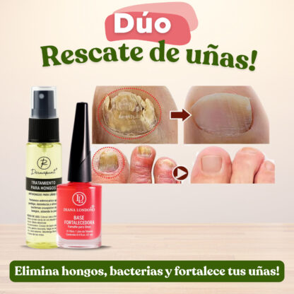 Tratamiento Eliminador de Hongos - Imagen 3