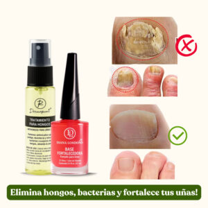 Dúo Rescate de uñas!